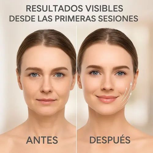 LumiLift Pro™ | Dispositivo Facial LED de Tecnología Avanzada
